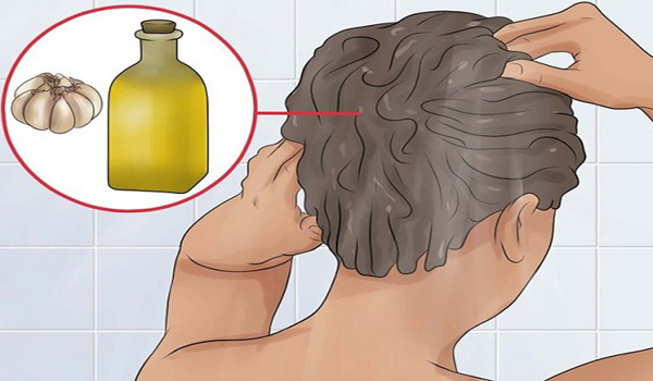 pérdida de pelo