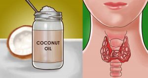 beneficios del aceite de coco