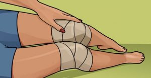 dolor de rodilla