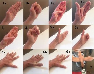 ejercicios artritis