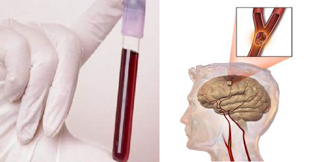análisis de sangre