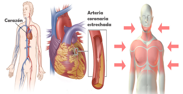 enfermedades de corazón
