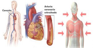 enfermedades de corazón