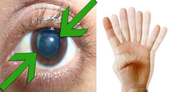 problemas de visión