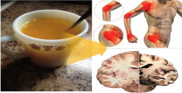 agua de cúrcuma
