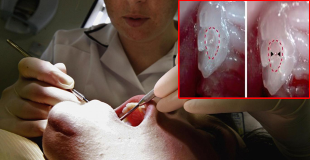 fármaco que regenera los dientes