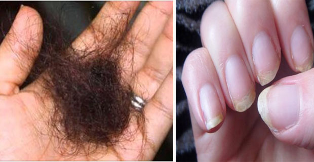 fortalecer uñas y cabello