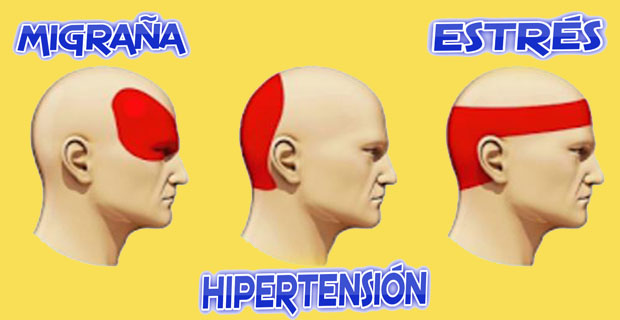 acupresión