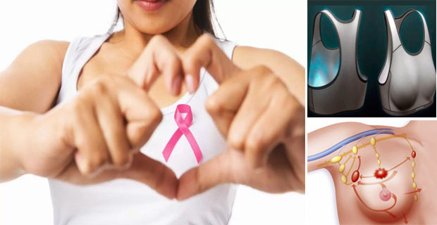 cáncer de mama