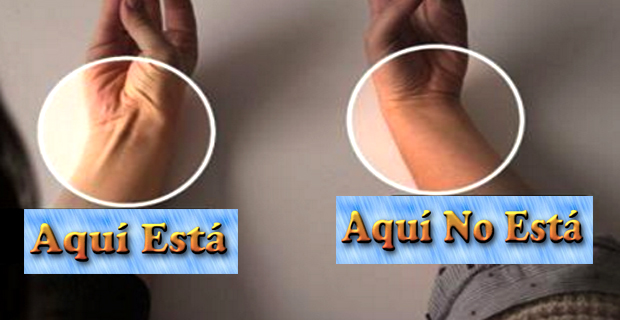 tendón