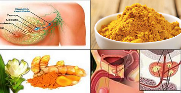 cáncer cúrcuma