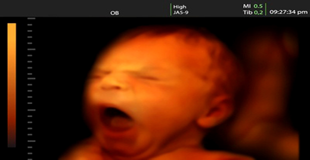 bebé
