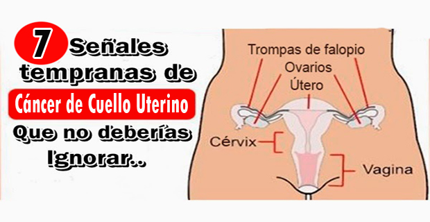 cáncer de cuello uterino