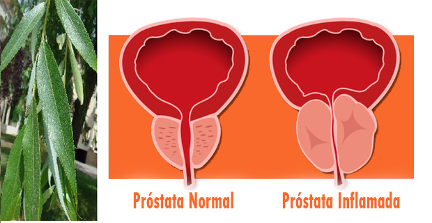 cáncer próstata